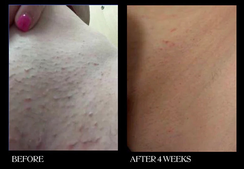 Brightening & Exfoliating Pads