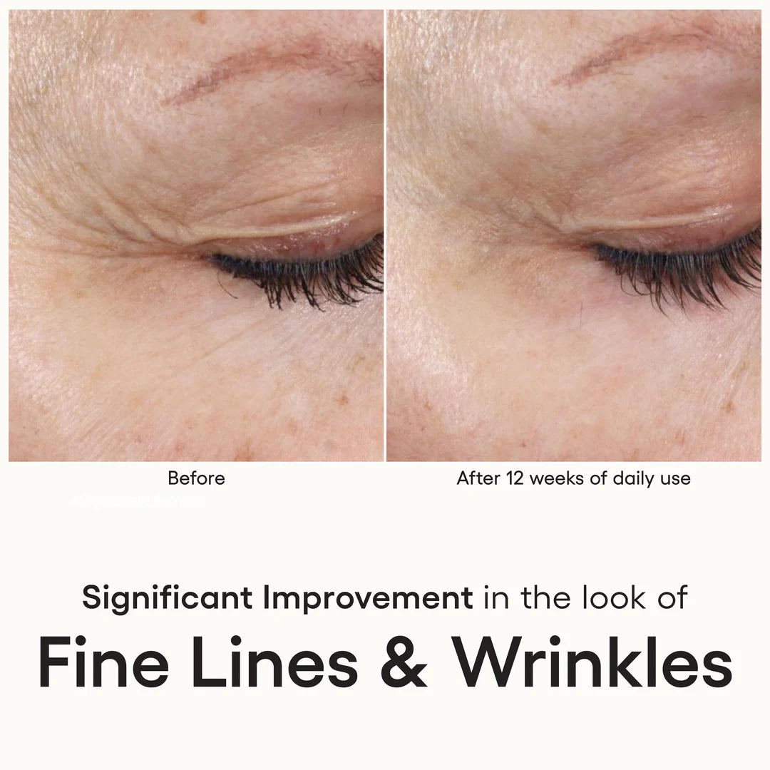Plated Intensive Serum