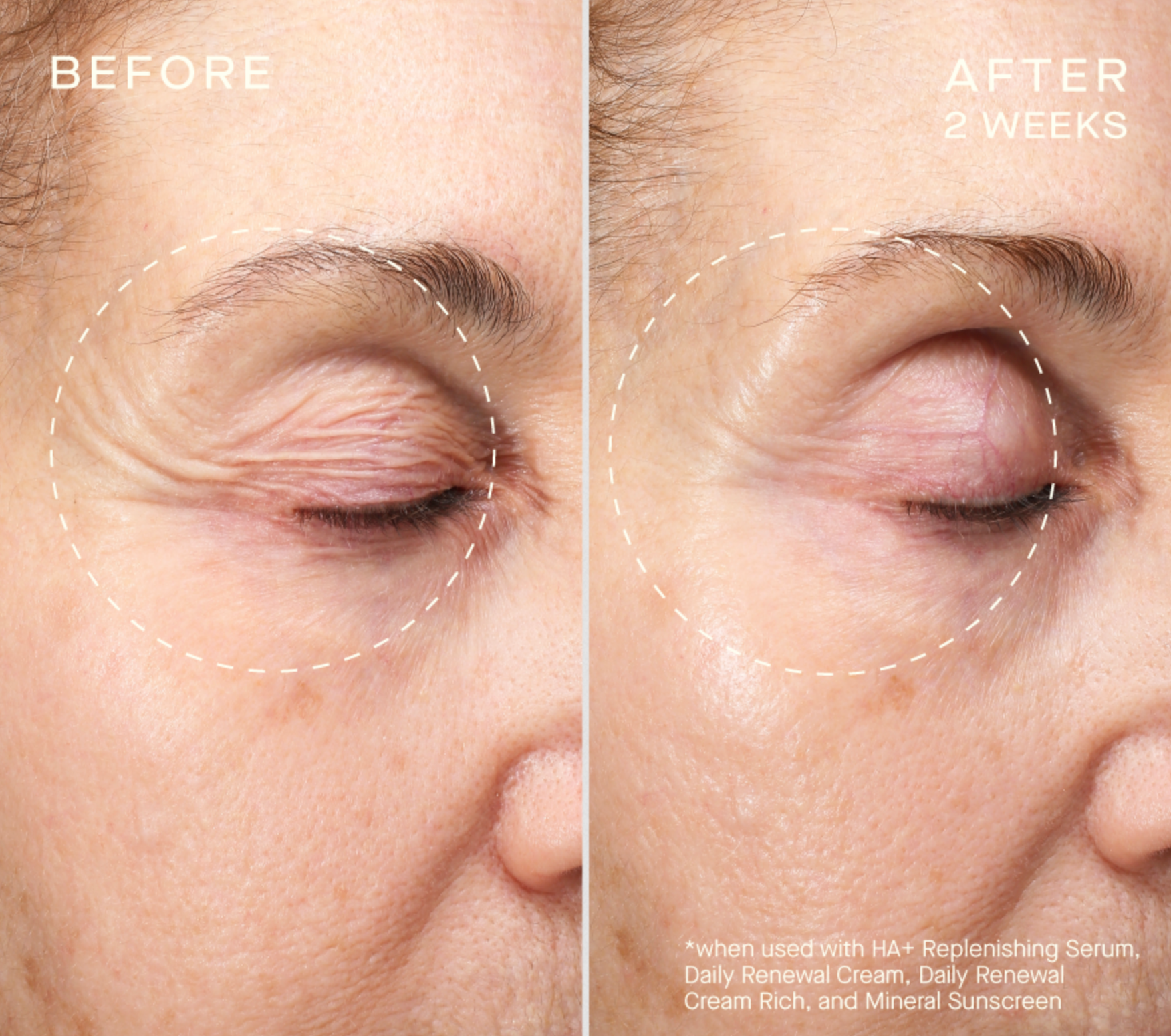HA+ Replenishing Serum with Tiered-Release Vesicle™ Technology