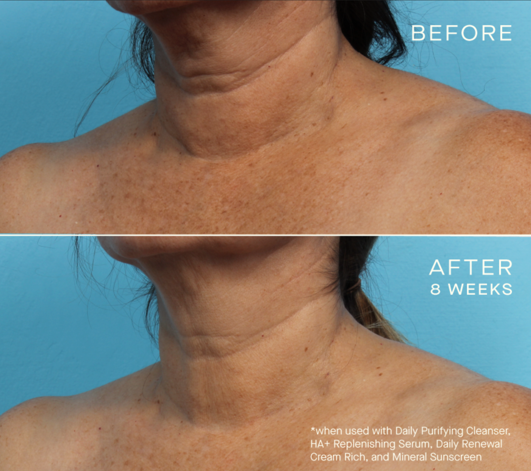 HA+ Replenishing Serum with Tiered-Release Vesicle™ Technology