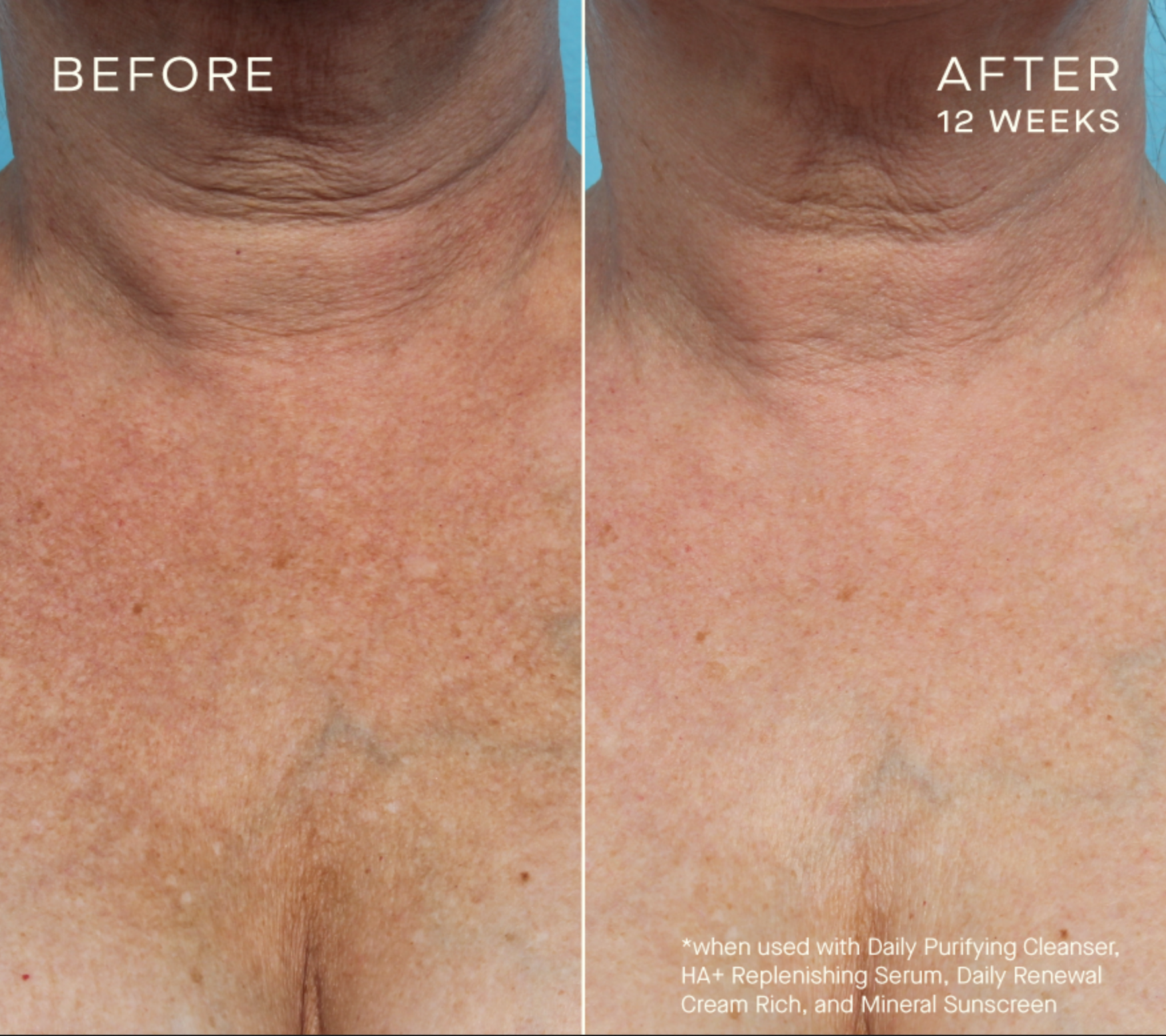 HA+ Replenishing Serum with Tiered-Release Vesicle™ Technology