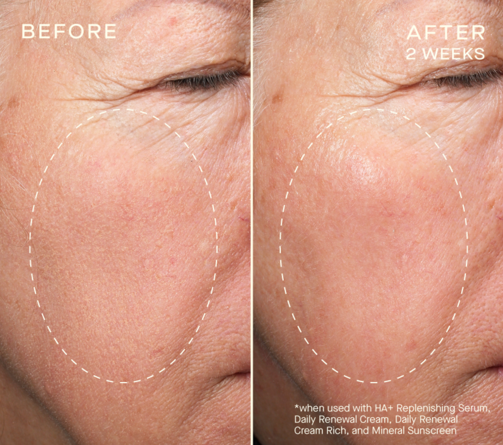 HA+ Replenishing Serum with Tiered-Release Vesicle™ Technology