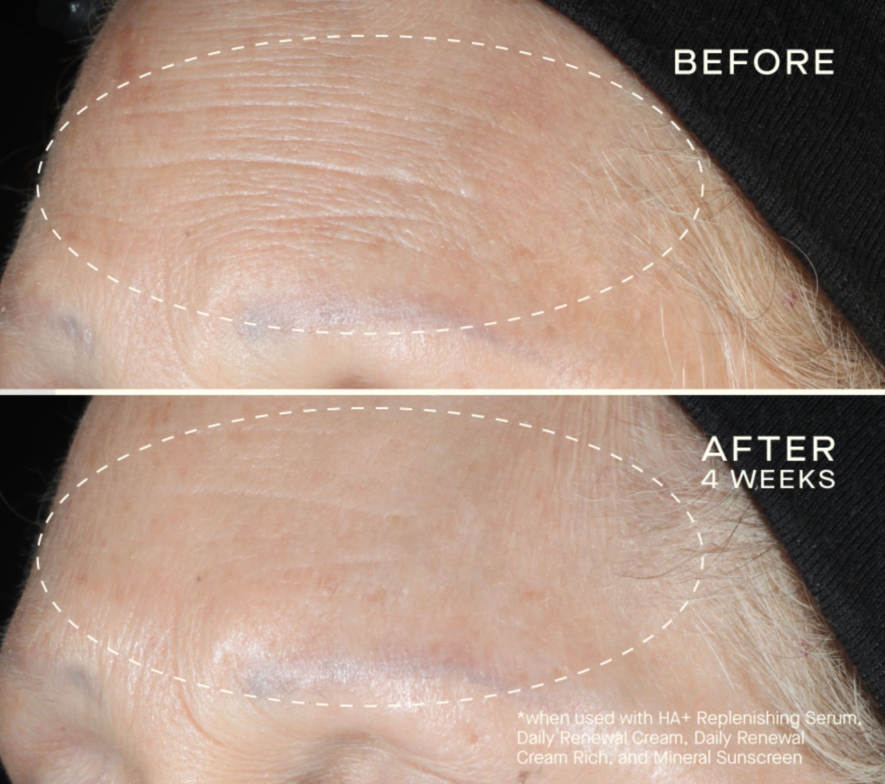 HA+ Replenishing Serum with Tiered-Release Vesicle™ Technology