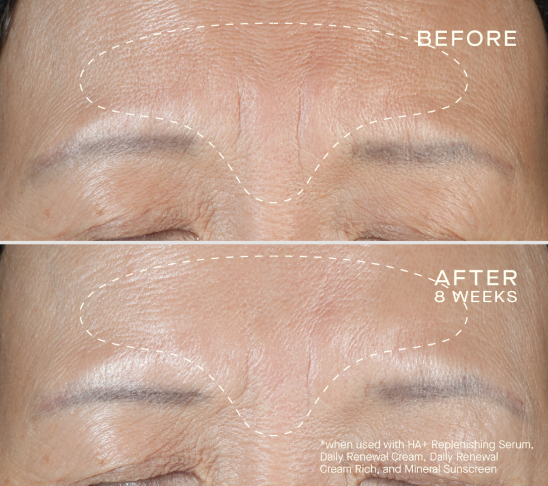 HA+ Replenishing Serum with Tiered-Release Vesicle™ Technology