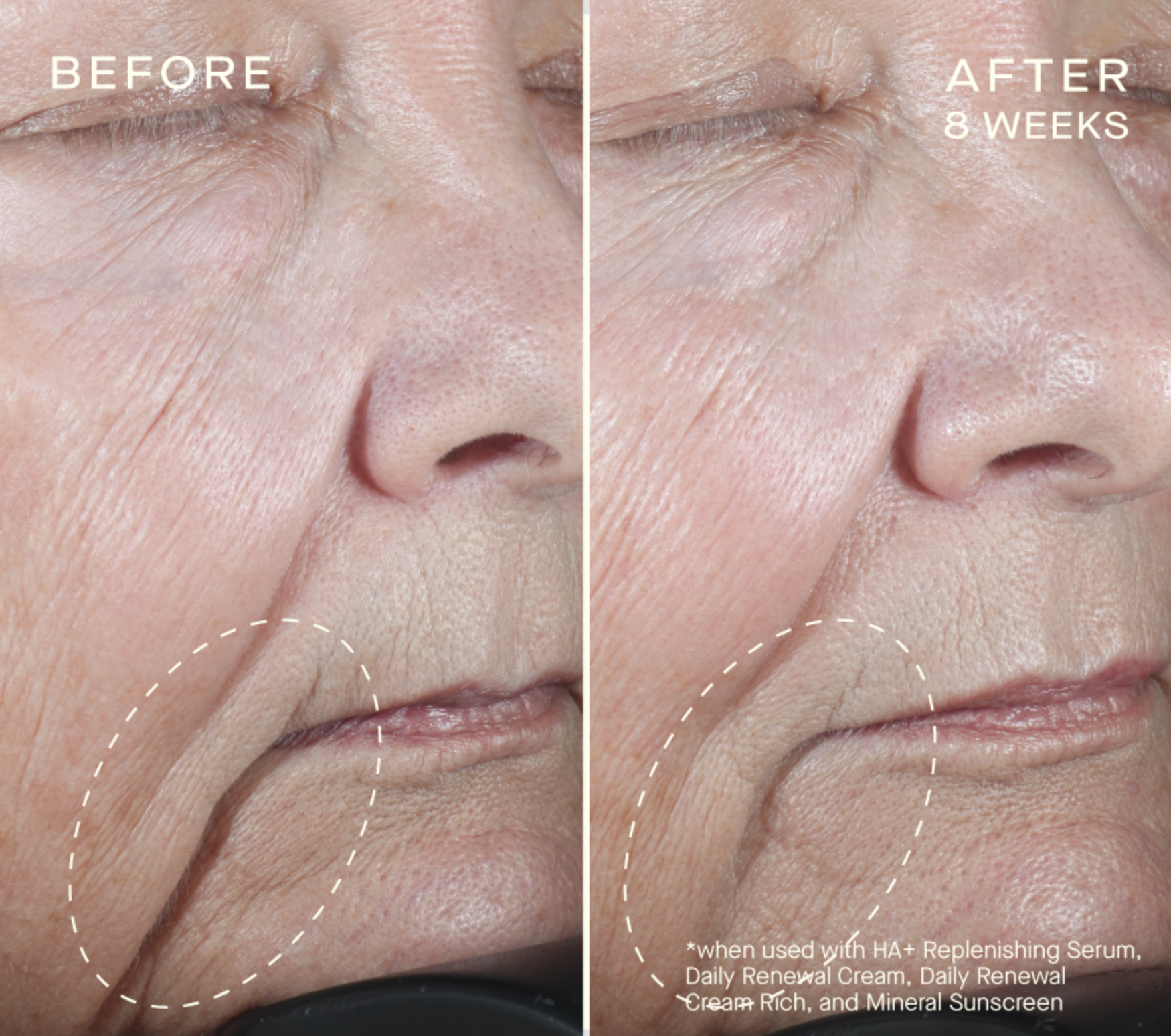 HA+ Replenishing Serum with Tiered-Release Vesicle™ Technology