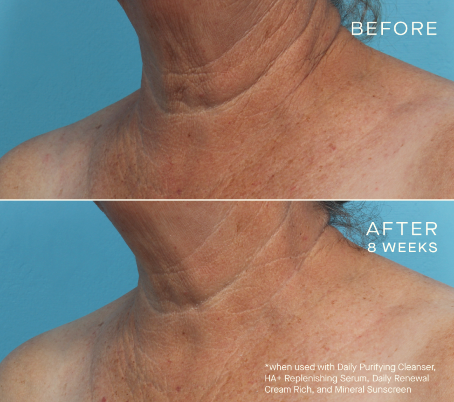 HA+ Replenishing Serum with Tiered-Release Vesicle™ Technology