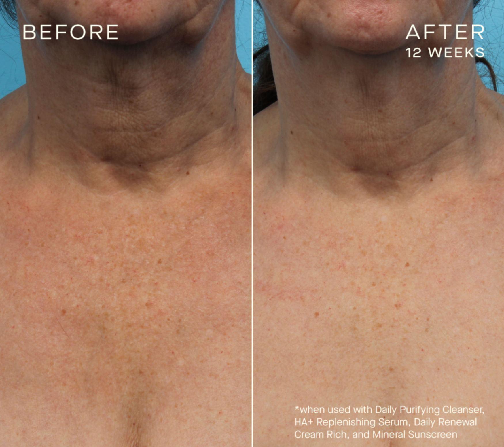 HA+ Replenishing Serum with Tiered-Release Vesicle™ Technology