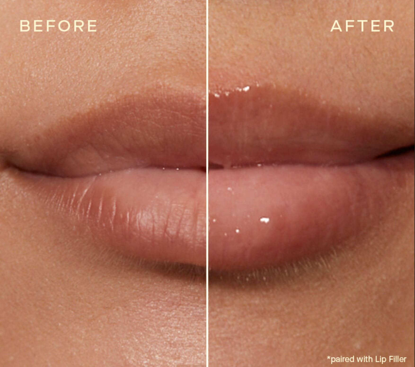 The Lip Plumping and Enhancing Regimen Fuller Lips + Glossy Finish