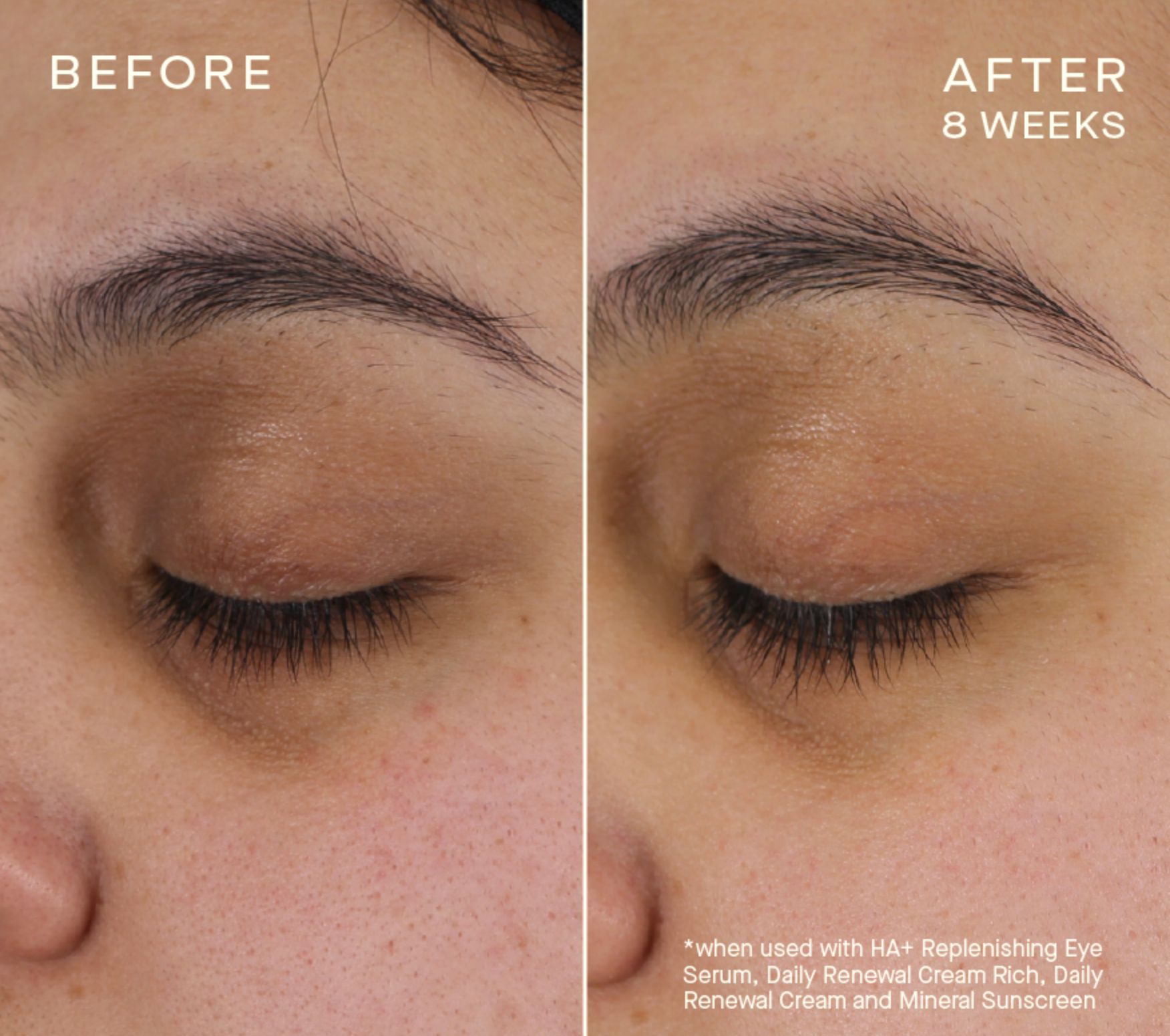 HA+ Replenishing Eye Serum with Tiered-Release Vesicle™ Technology