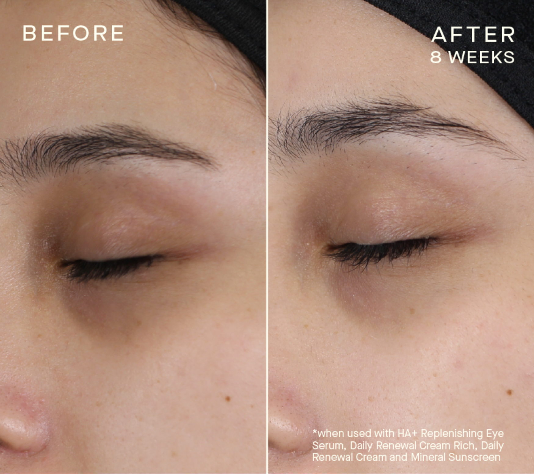 HA+ Replenishing Eye Serum with Tiered-Release Vesicle™ Technology