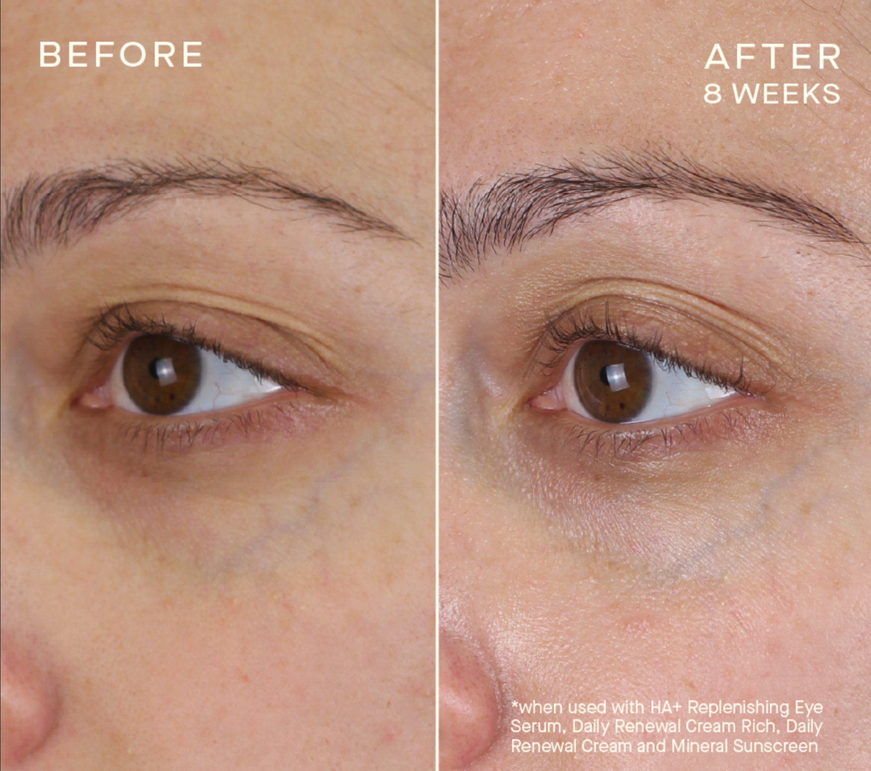 HA+ Replenishing Eye Serum with Tiered-Release Vesicle™ Technology