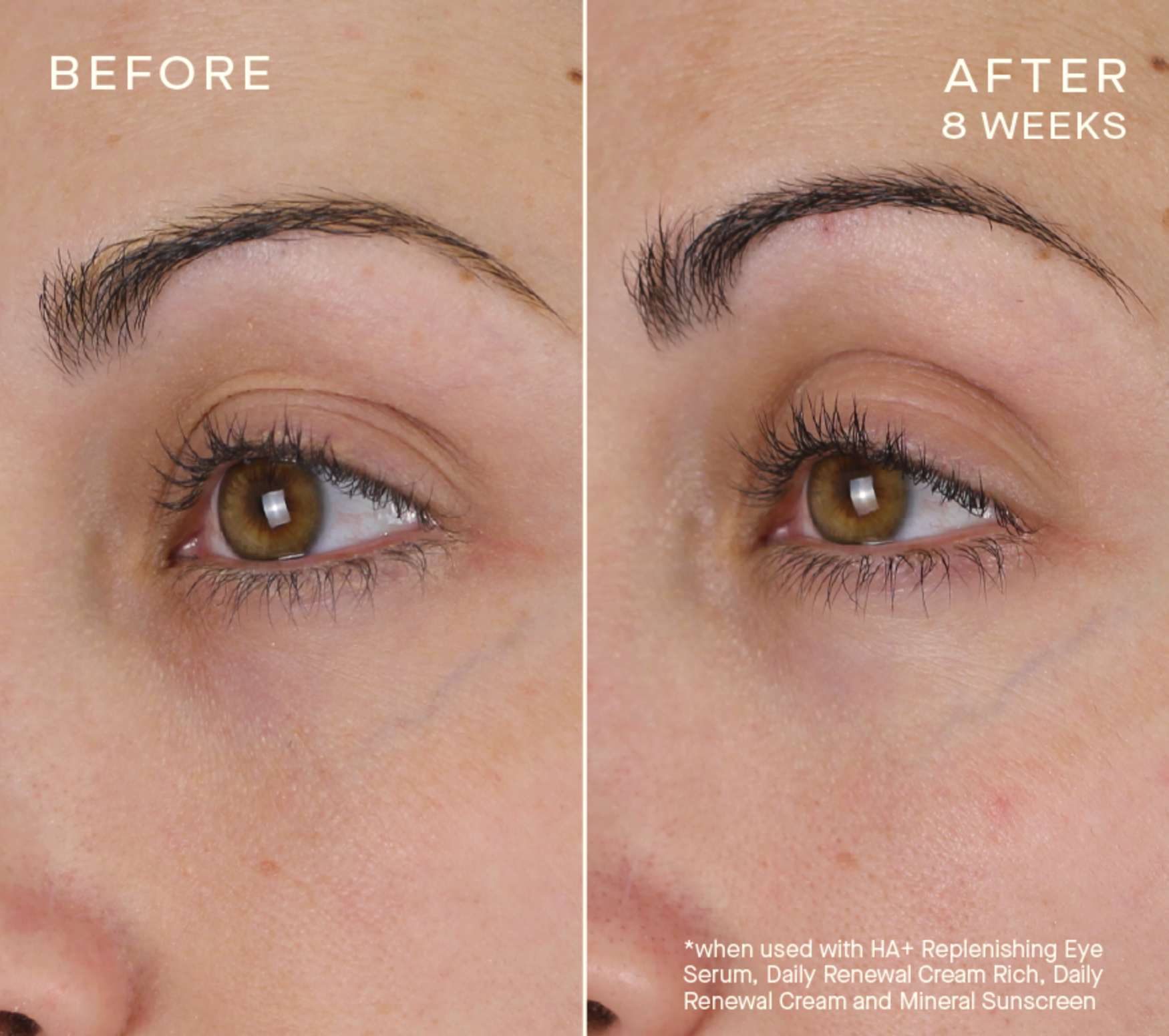 HA+ Replenishing Eye Serum with Tiered-Release Vesicle™ Technology