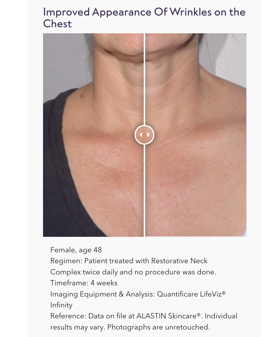 Restorative Neck Complex with TriHex Technology®