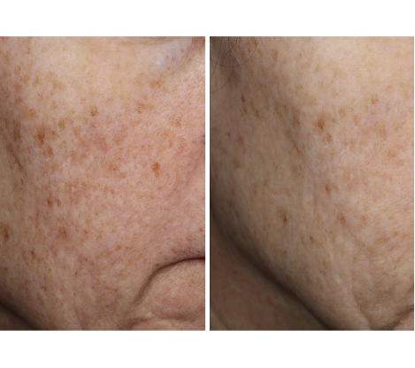 Complexion Brightening Serum