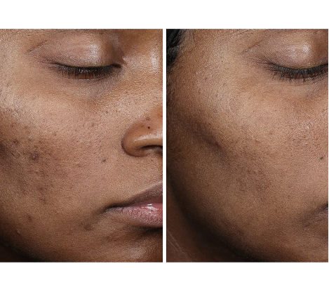 Complexion Brightening Serum