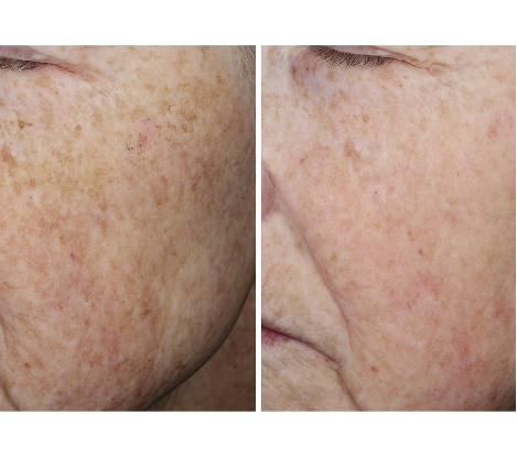 Complexion Brightening Serum