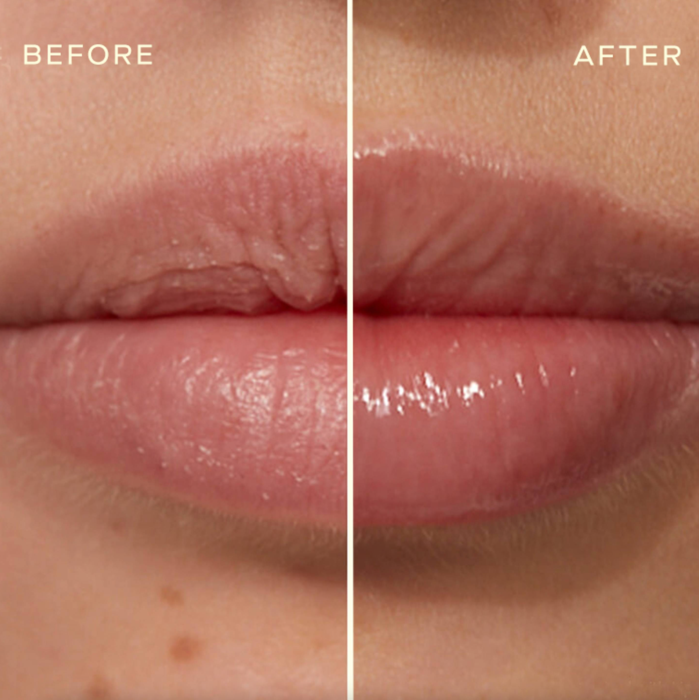 Your Best Lips Gift Set