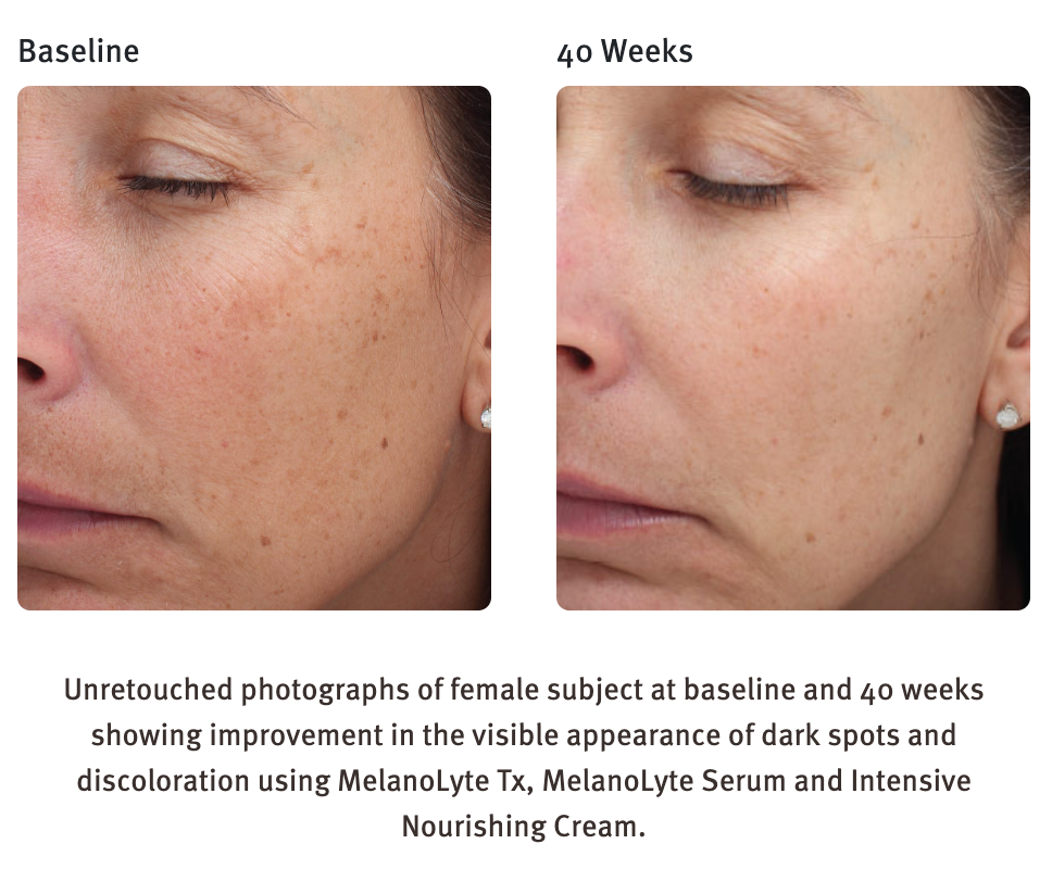Intensive Nourishing Cream