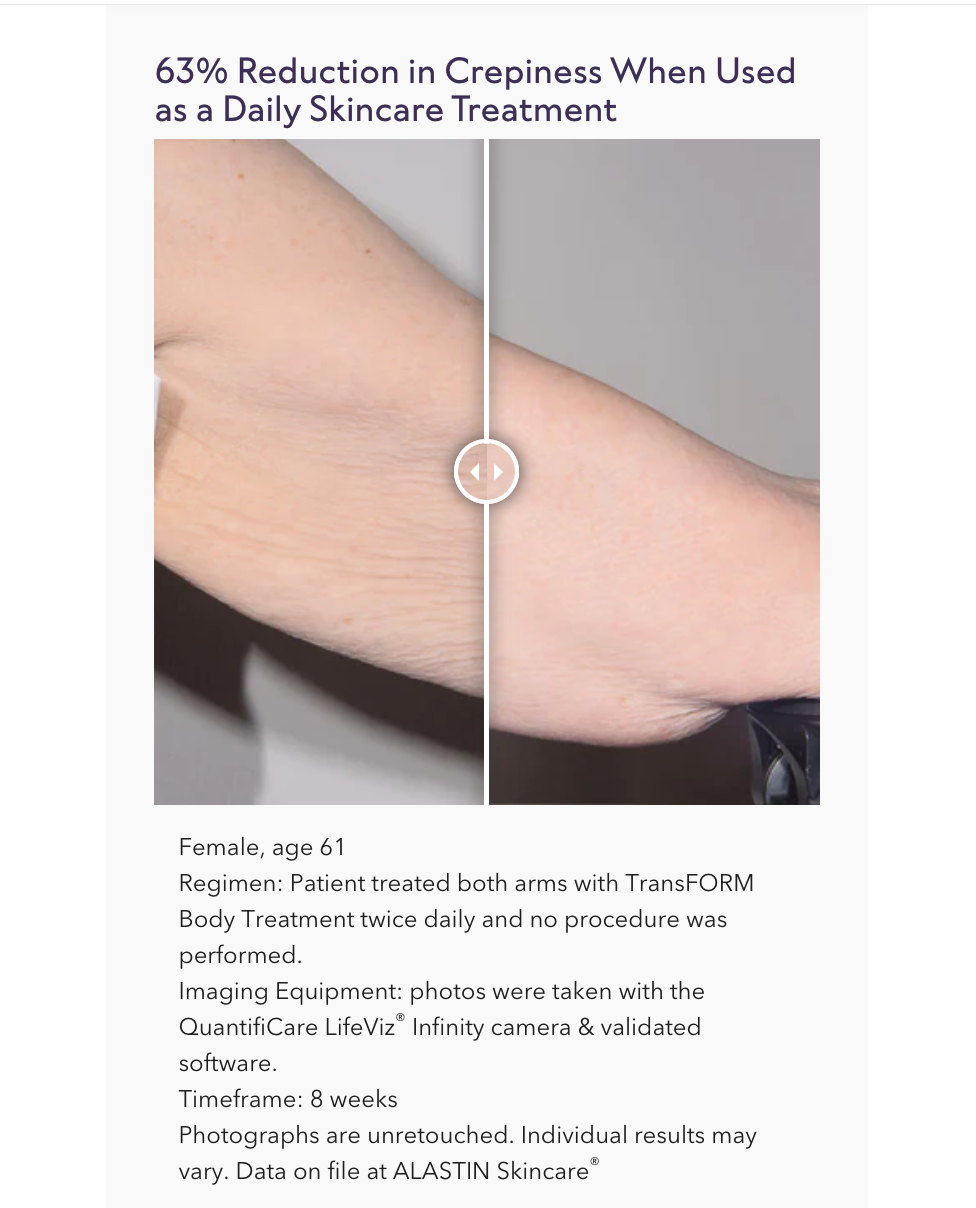 TransFORM Body Treatment with TriHex Technology®