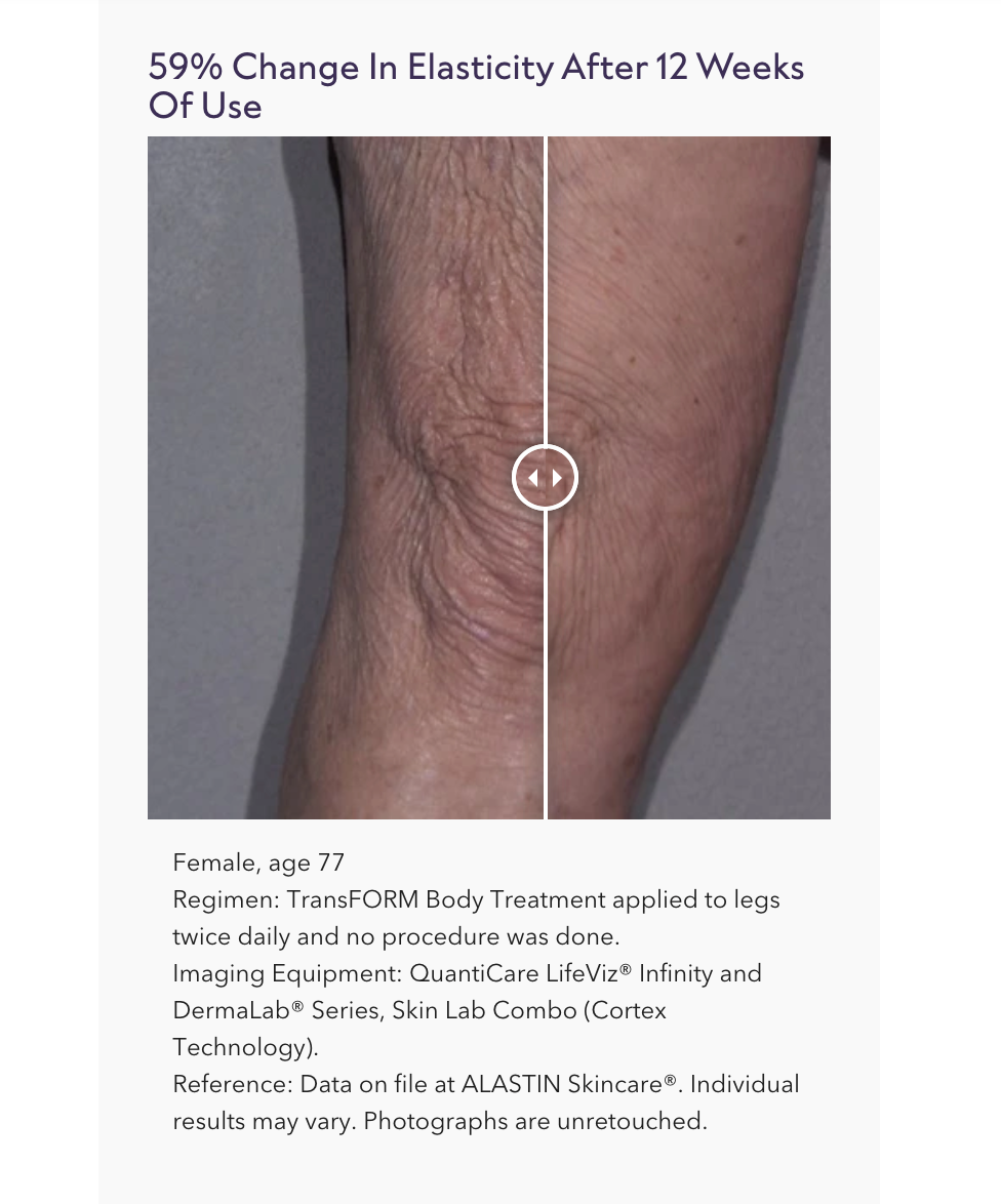 TransFORM Body Treatment with TriHex Technology®