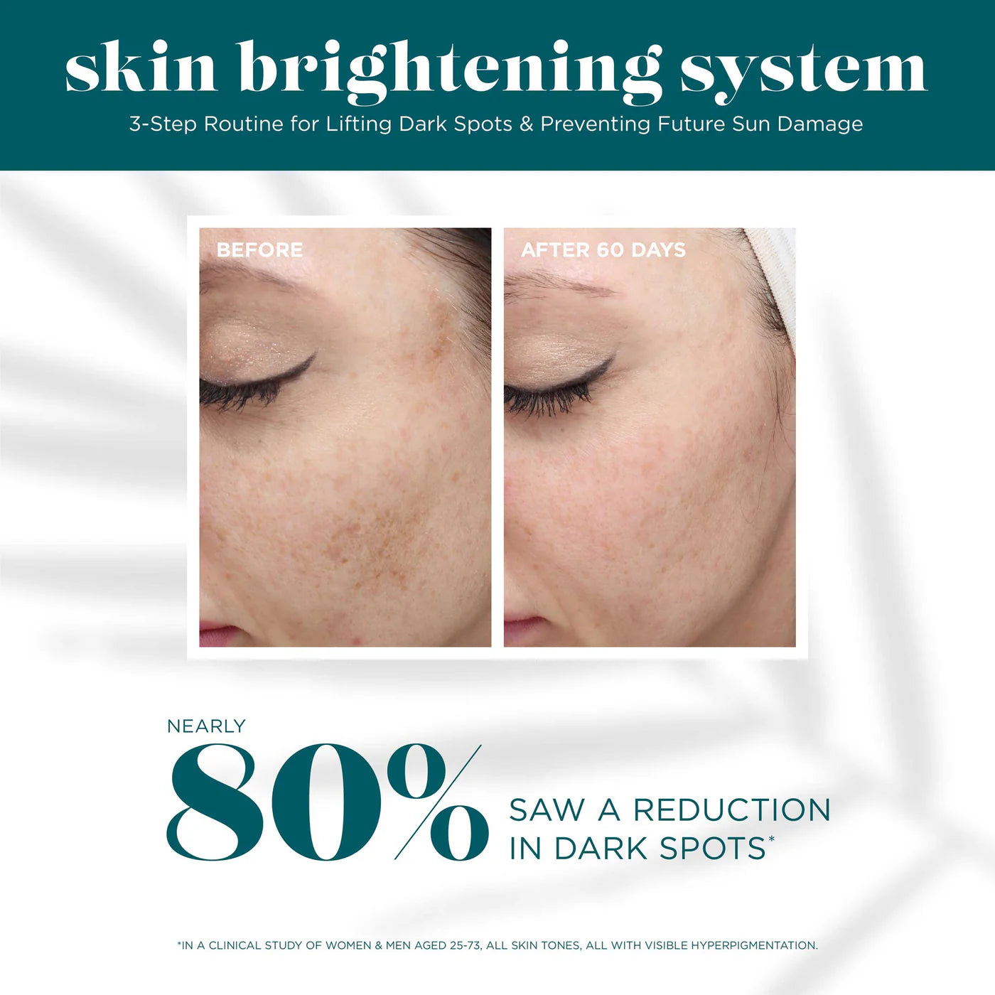 Skin Brightening System - VI