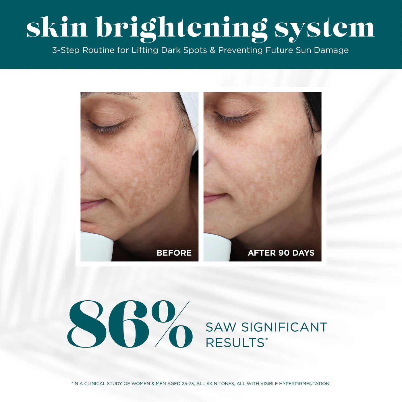 Skin Brightening System - VI